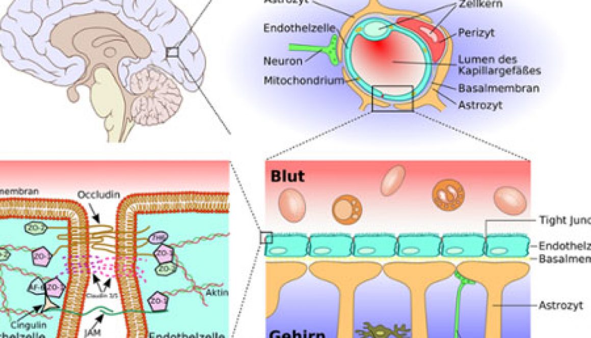 blog-leaky-brain