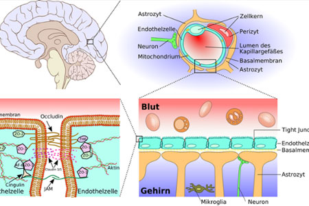 blog-leaky-brain blog-leaky-brain