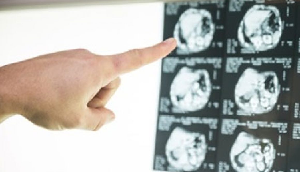 blog-what-is-neurofeedback