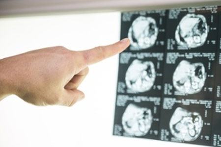 blog-what-is-neurofeedback blog-what-is-neurofeedback